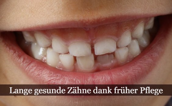 Zahnpflege Kleinkind