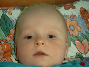 Der Babykopf