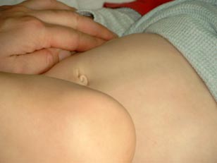 Nabelpflege